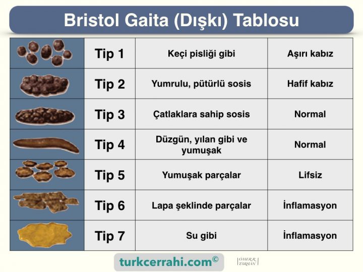 Bristol gaita, dışkı tablosu