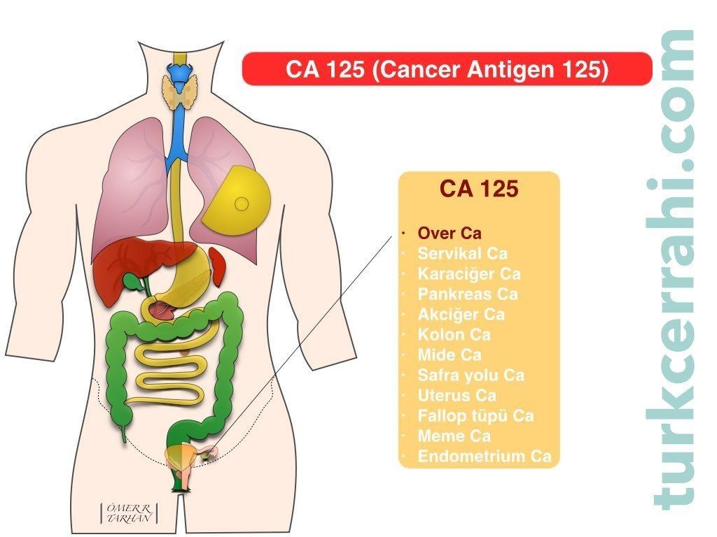 CA 125 (Kanser Antijen 125)