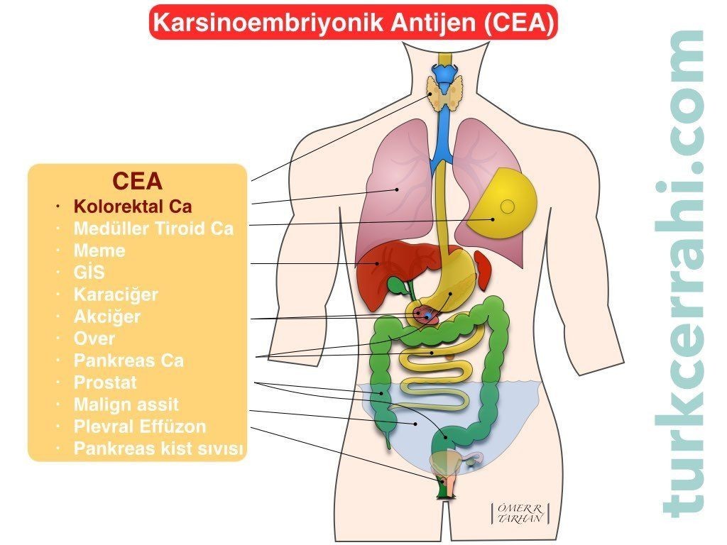 CEA (karsinoembriyonik antijen)