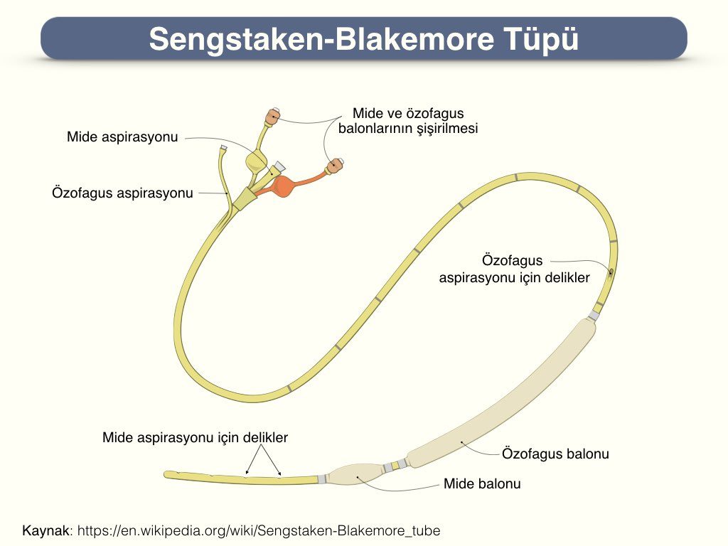 Sangstaken Blakemore tüpü