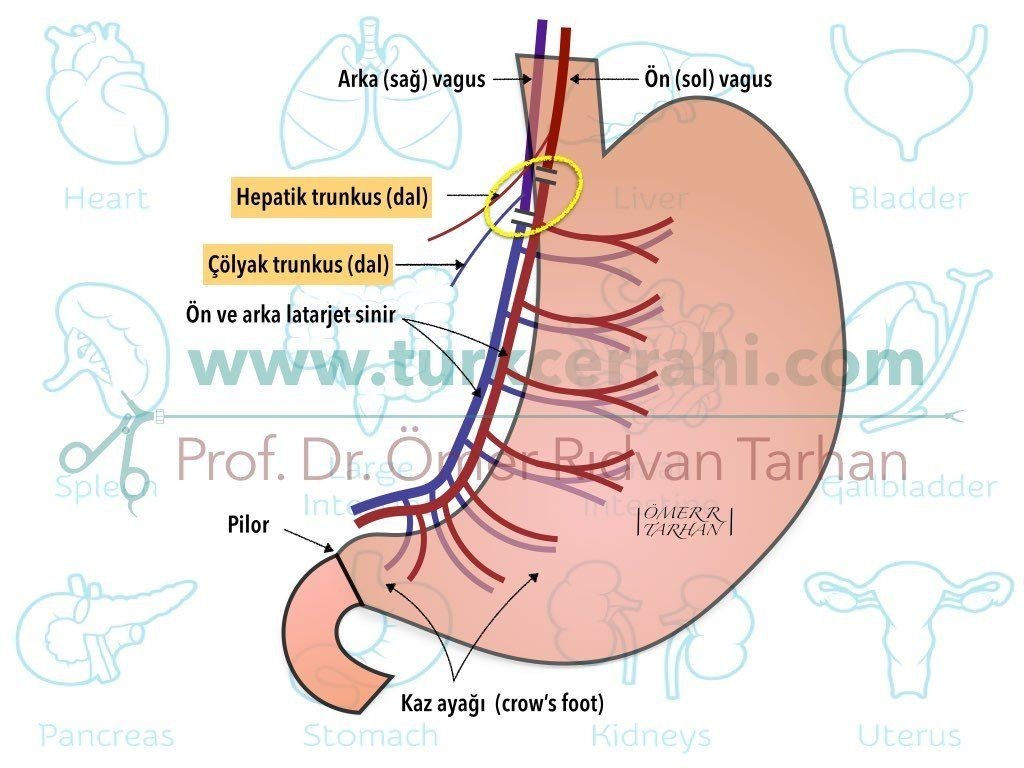 Selektif Vagotomi Selective Vagotomy