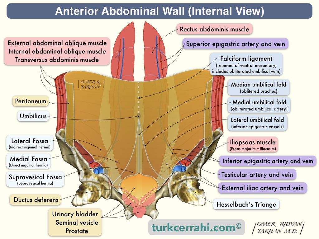 ummD - Hernias