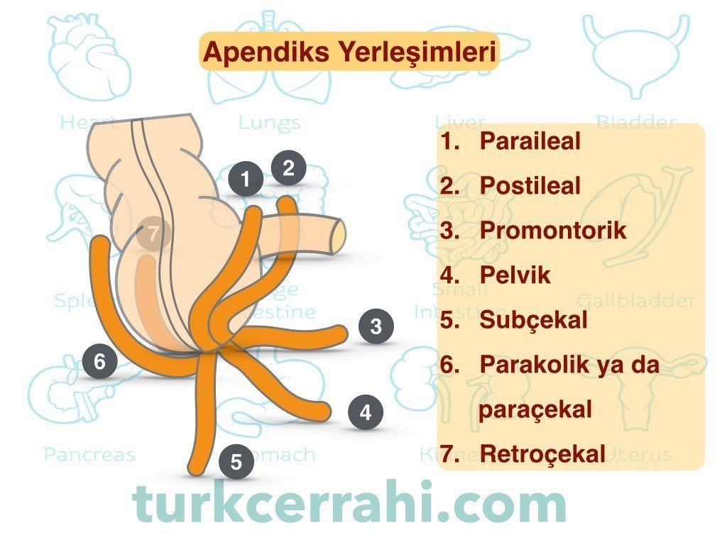 Apendiks yerleşimleri