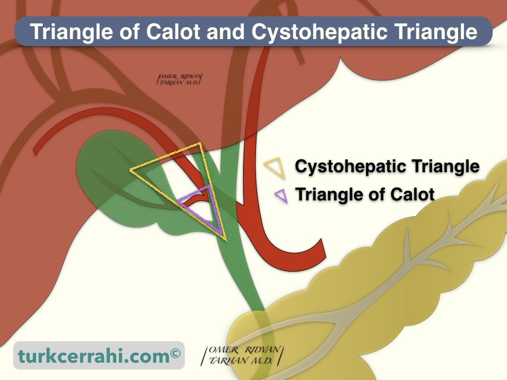 Calot's and cystohepatic triangle