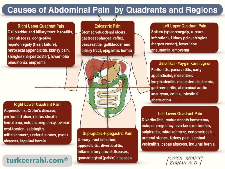 Causes of abdominal pain by quadrants and regions