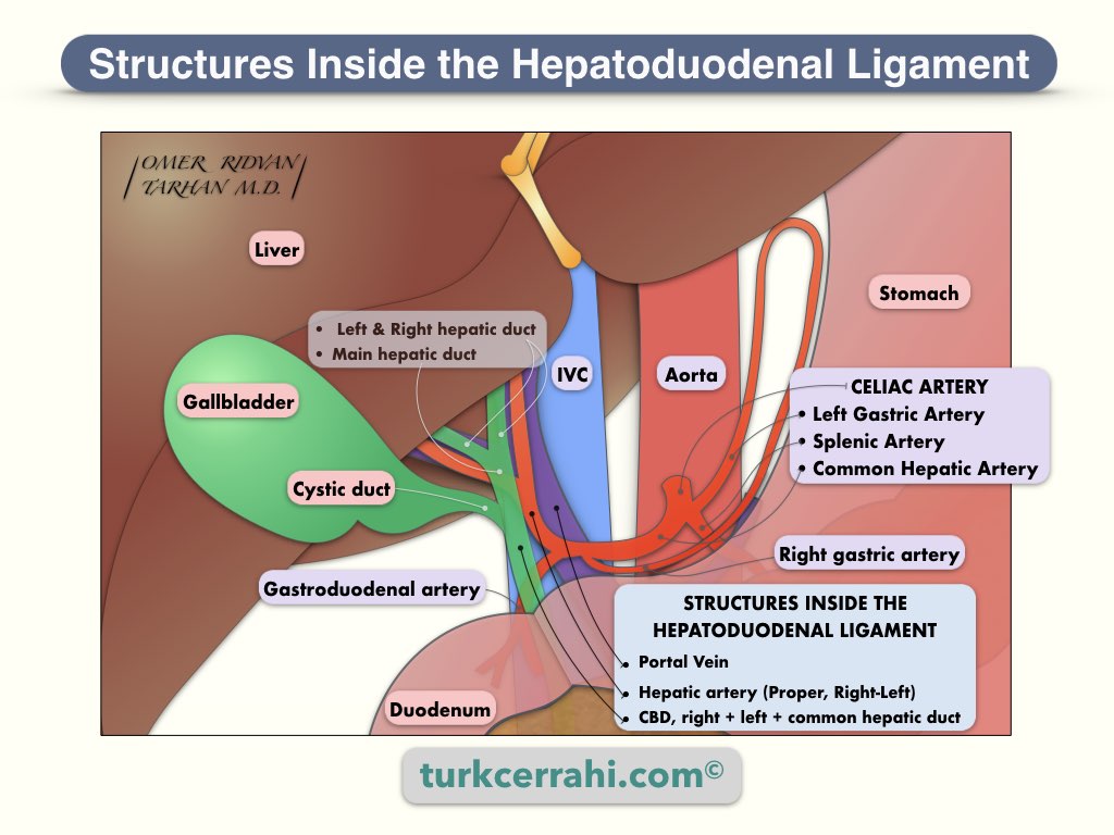 Hepatoduodenal ligament contains the common bile duct, hepatic artery, portal vein, lymphatics, and nerves.