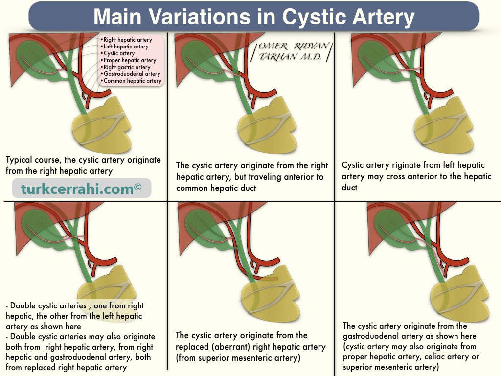 Cystic artery variations