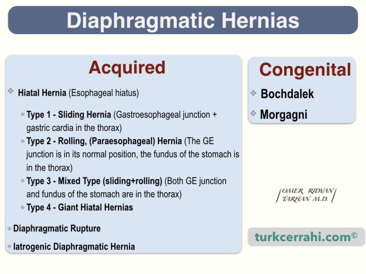 Diaphragm hernia types