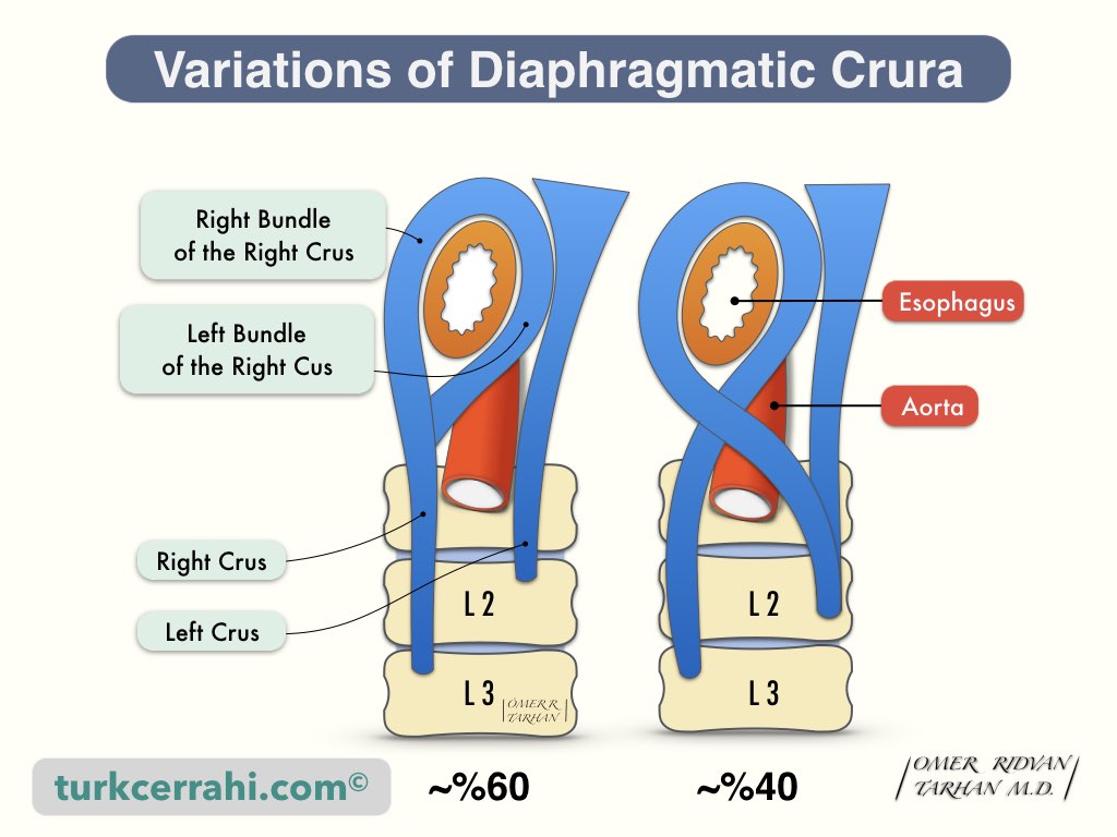 Variations of Diaphragmatic Crura