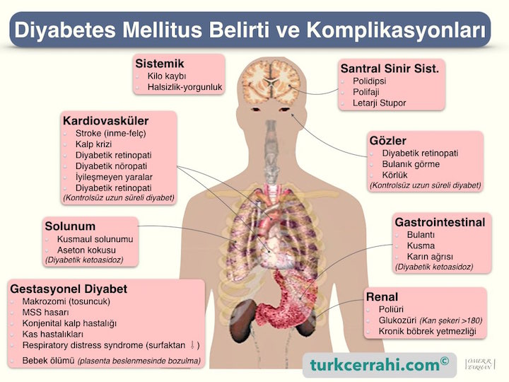 Diyabet (şeker hastalığı) belirtileri (semptomları) ve komplikasyonları