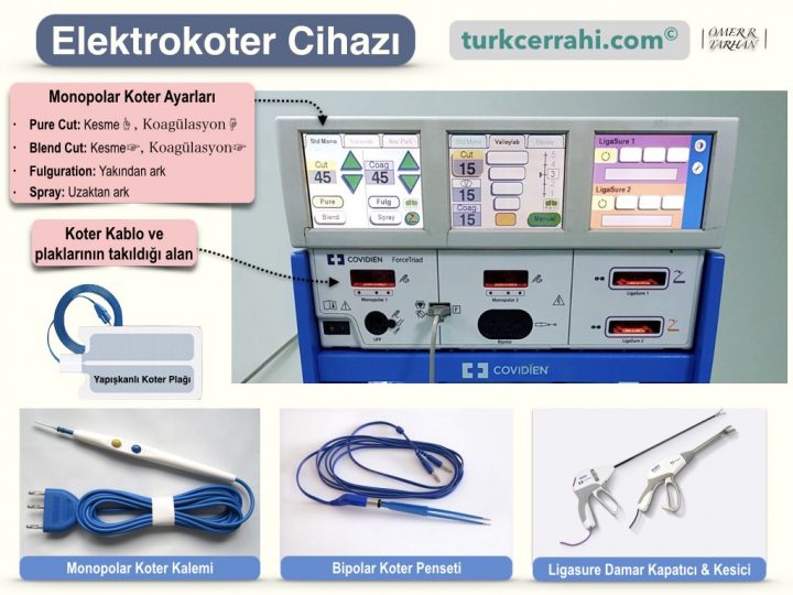 Elektrokoter; monopolar, bipolar, ligasure