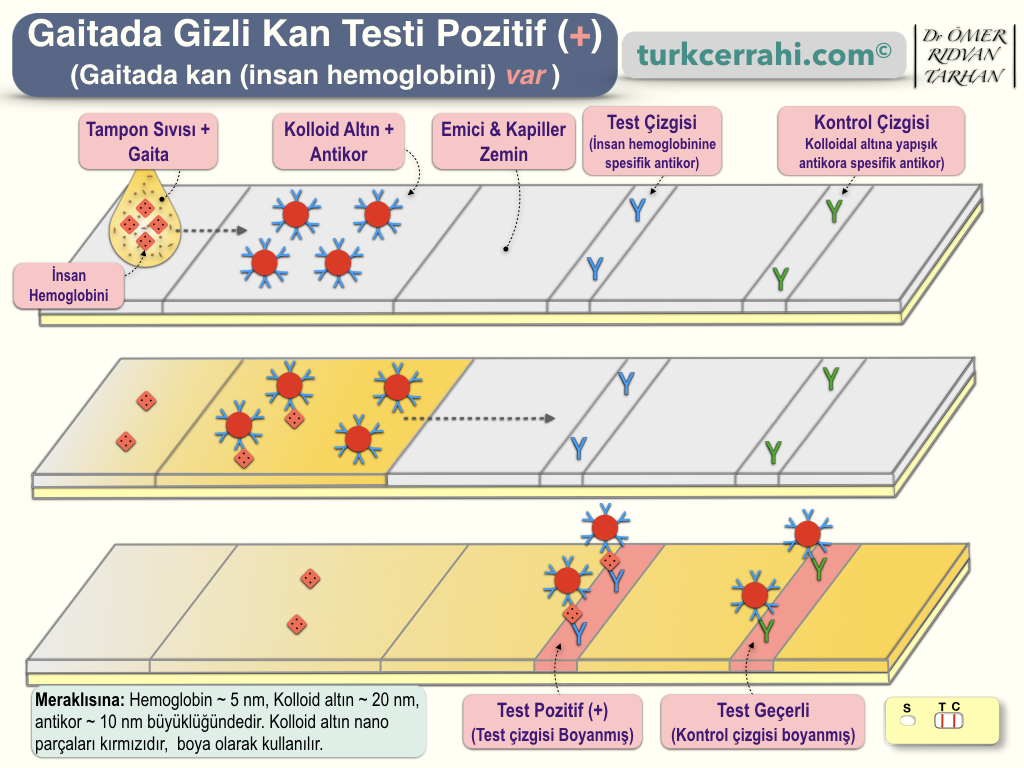 Gaitada Gizli Kan Testi Pozitif