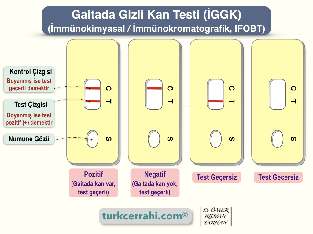 gaitada gizli kan testi turkcerrahi com