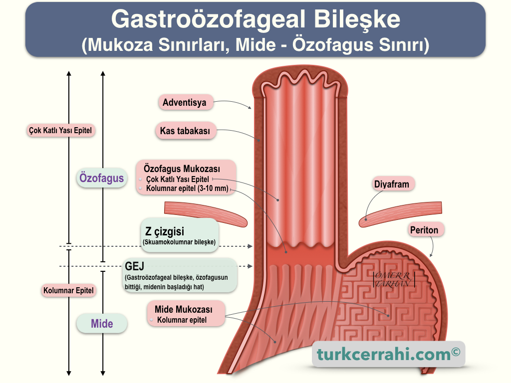 Gastoözofageal Bileşke (Mukoza Sınırları, Mide-Özofagus Sınırı)