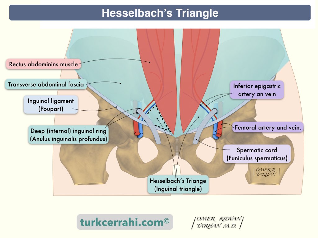 3. Anatomy of the Inguinal Canal - Inguinal Hernias