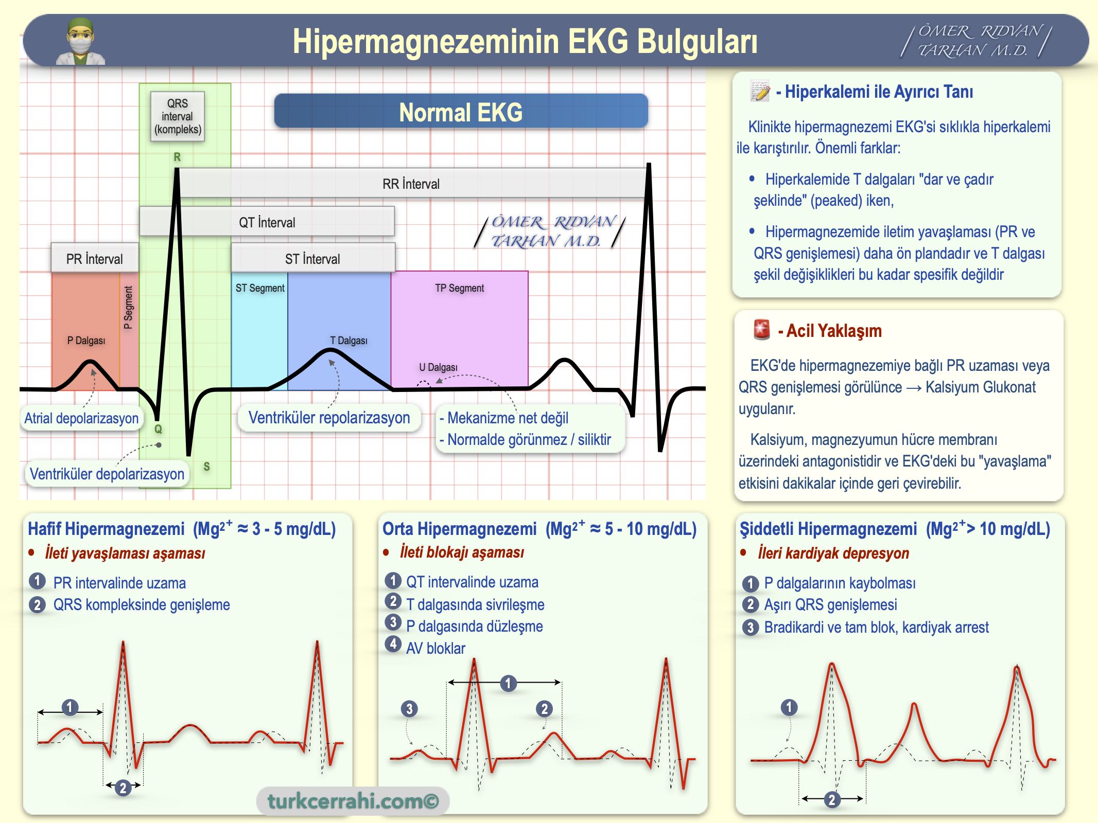 Hipermagnezemi'nin EKG bulguları