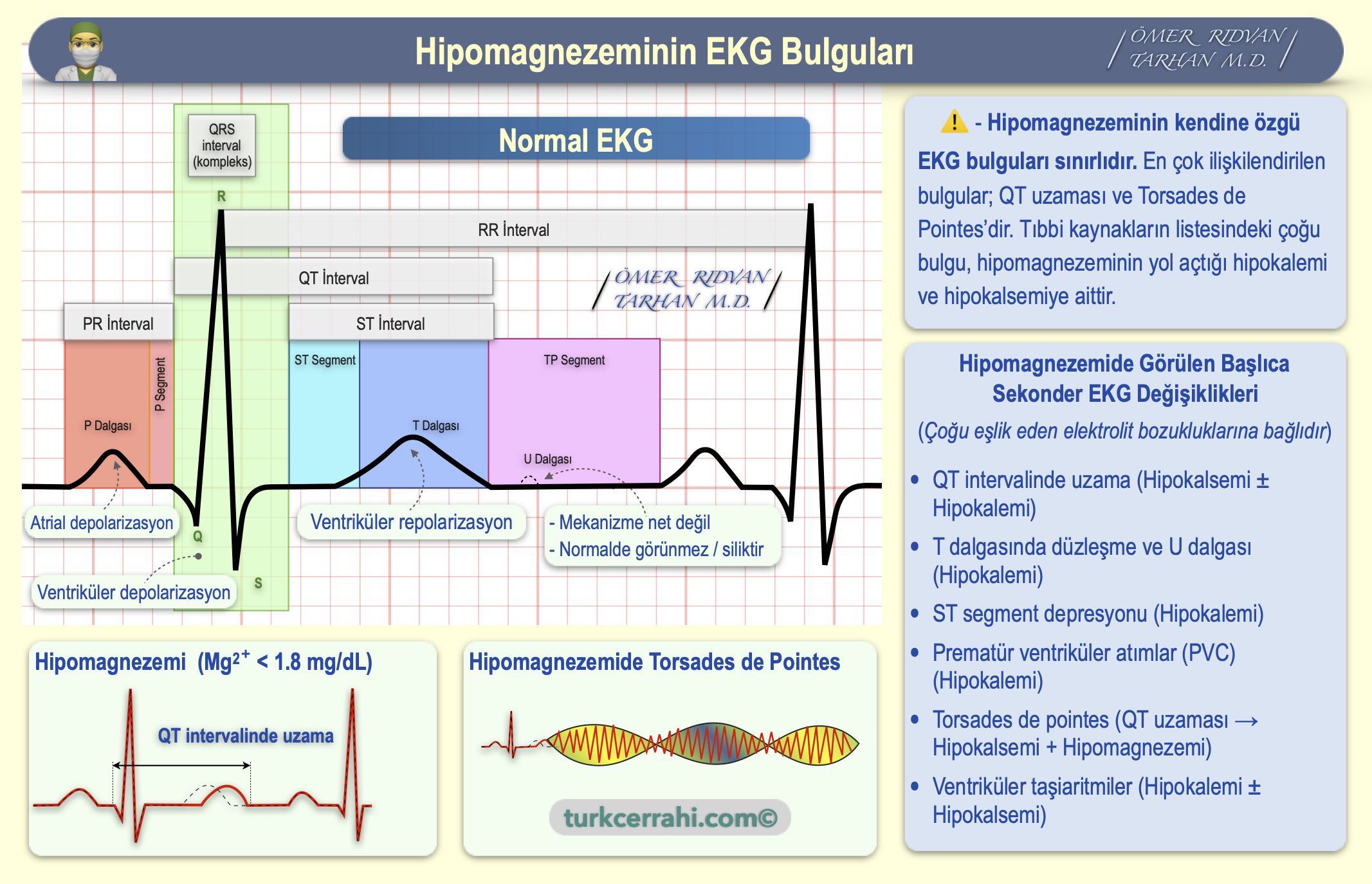 Hipomagnezemi EKG bulguları