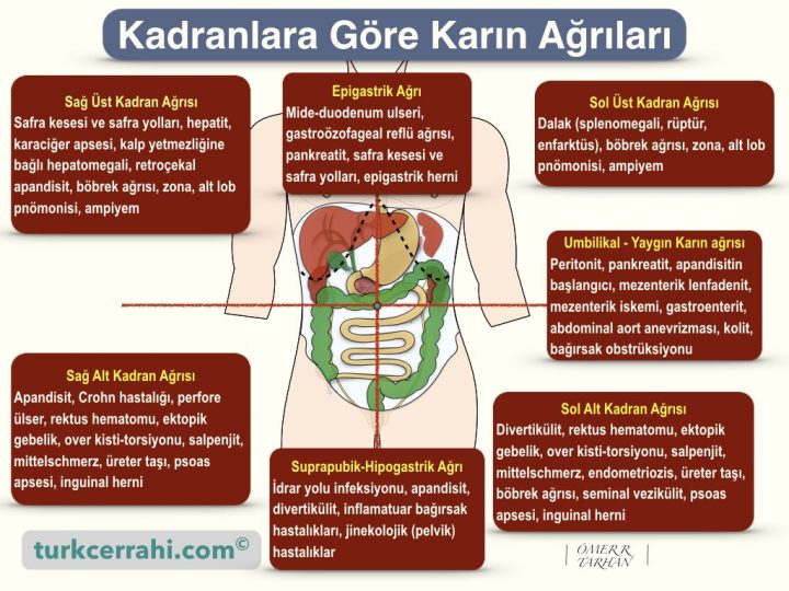 Kadranlara göre karın ağrısı