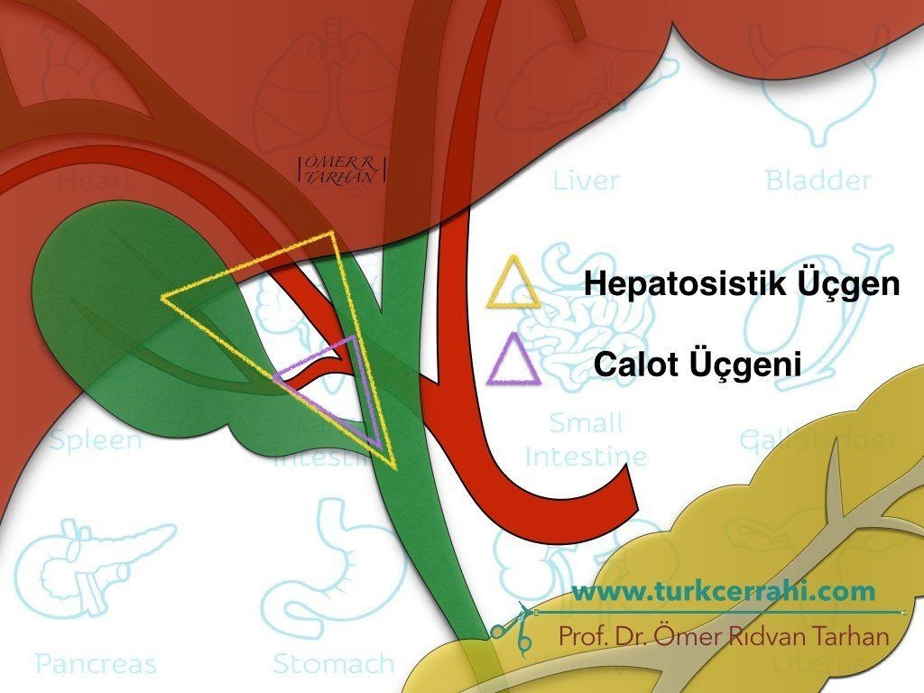 Kalot (Calot) üçgeni ve hepatosistik üçgen