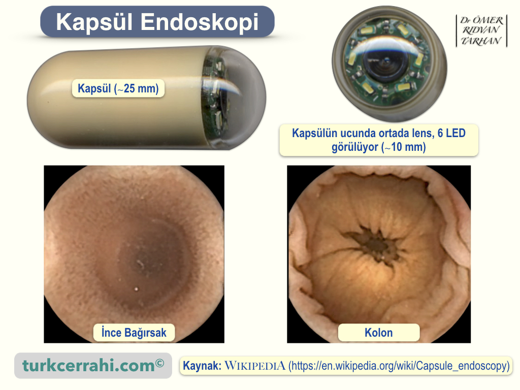 Kapsül Endoskopi
