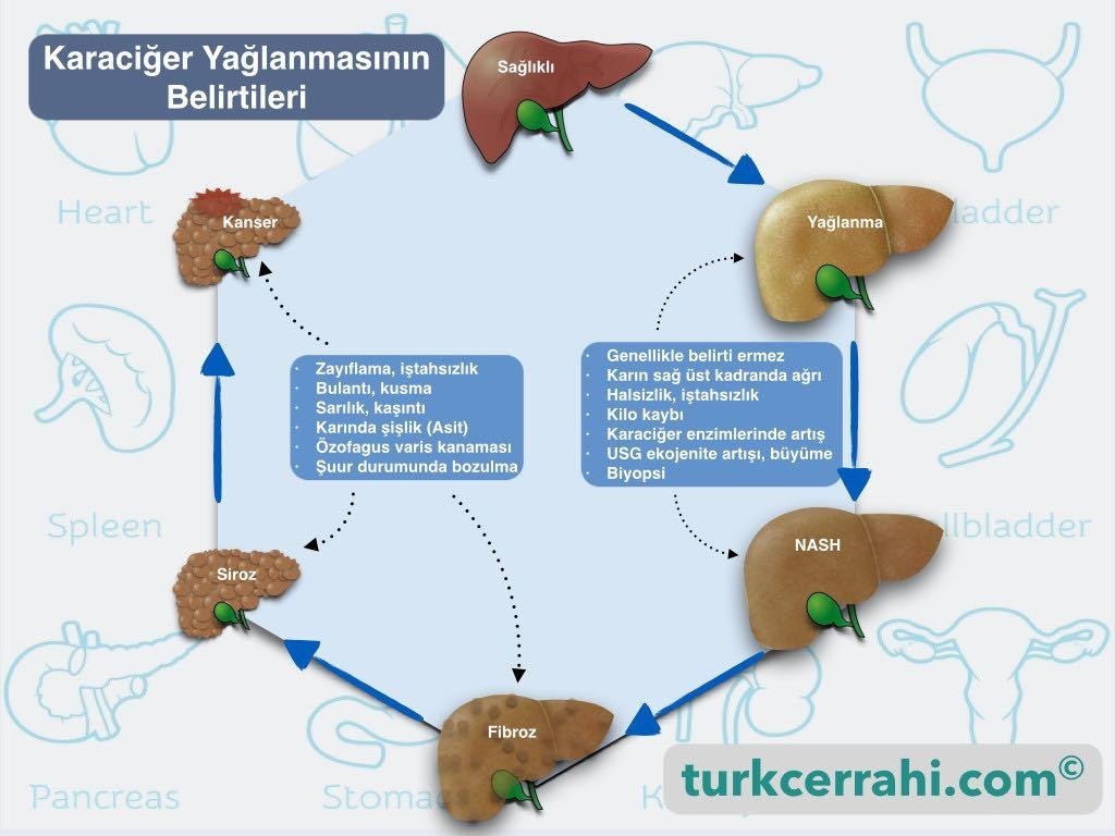 Karaciğer yağlanması belirtileri