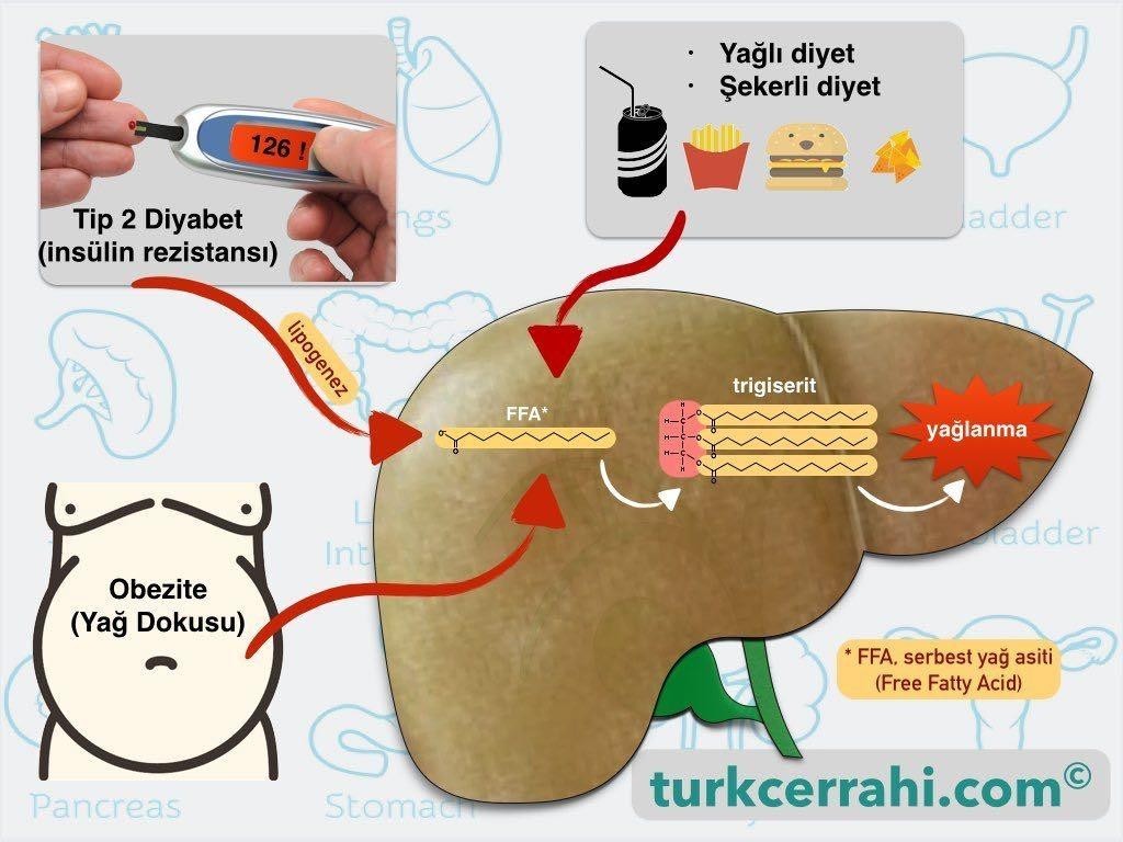 Karaciğer yağlanması nedenleri (neden olur)