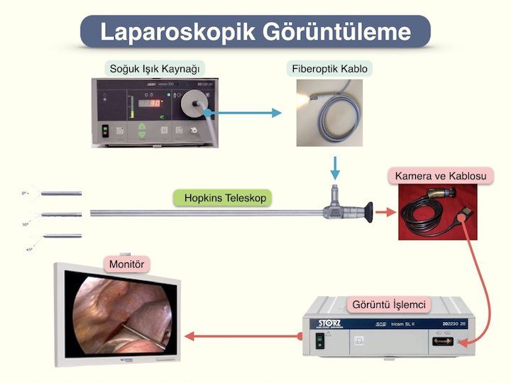 Laparoskopi cihazı görüntüleme