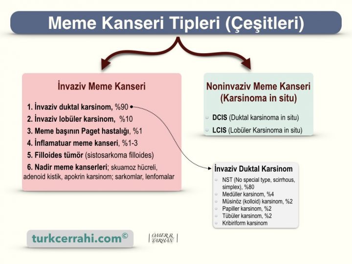 Meme kanseri tipleri (çeşitleri)