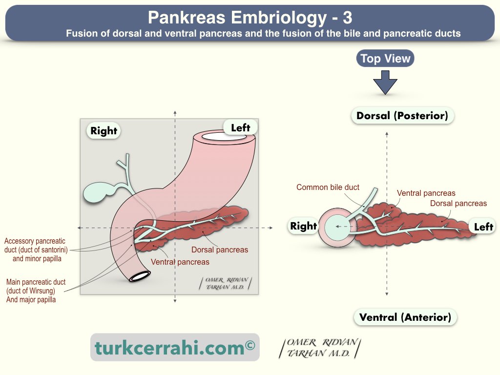 Pancreas embryology: fusion of dorsal and ventral pancreas