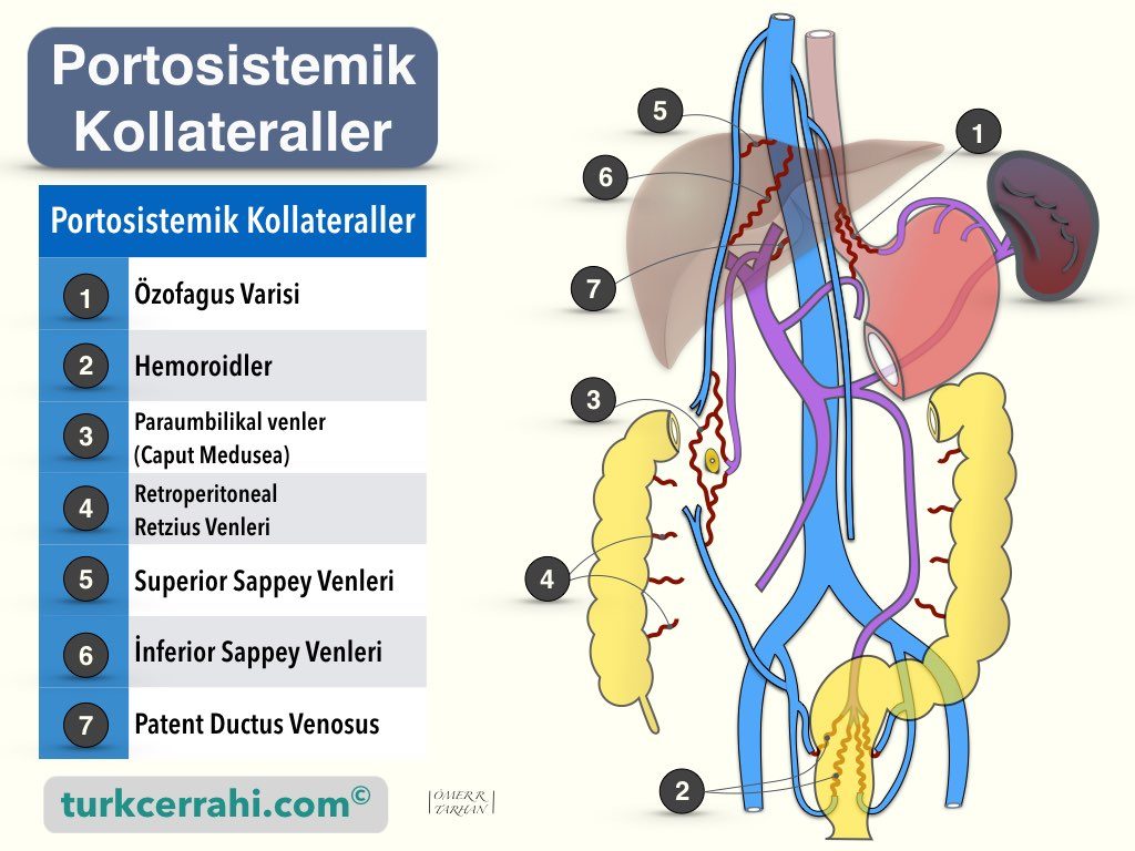 Portal hipertansiyon kollateraller