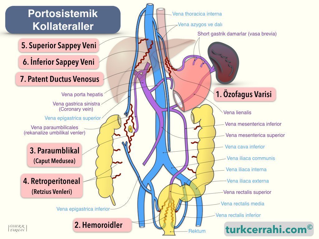 Portosistemik kollateraller