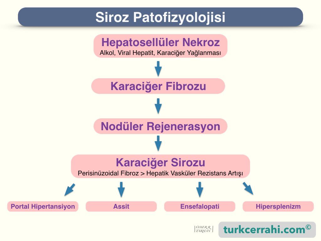 Siroz patofizyolojisi