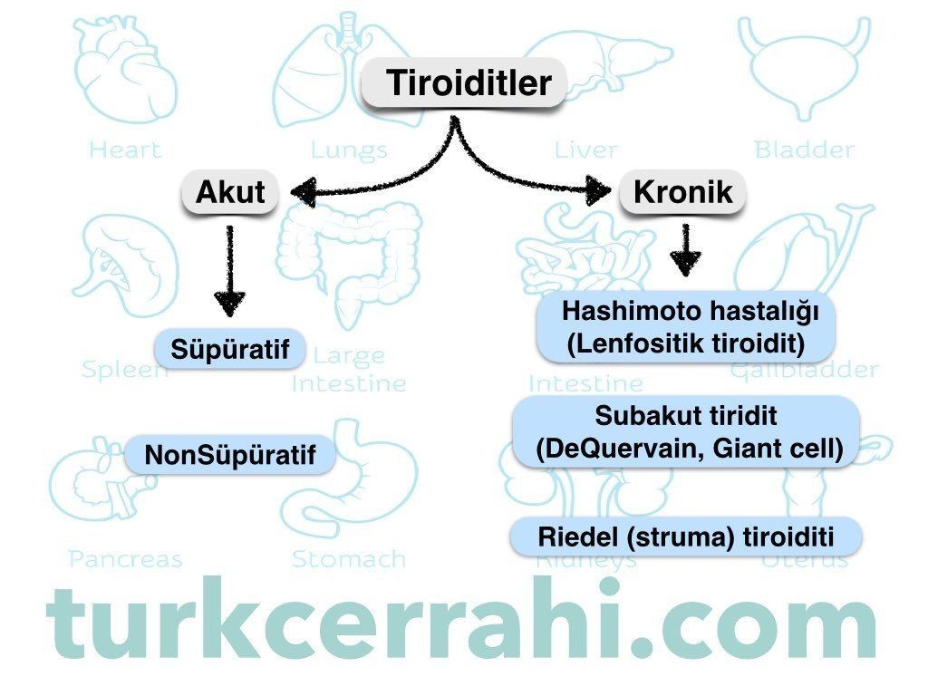 Tiroidit çeşitleri