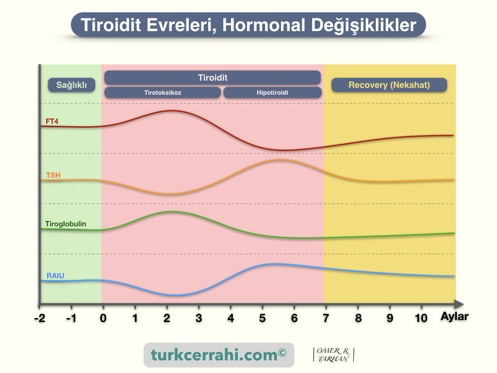Tiroidit Evreleri: Tirotoksikoz (hipertiroidi), hipotiroidi ve iyileşme